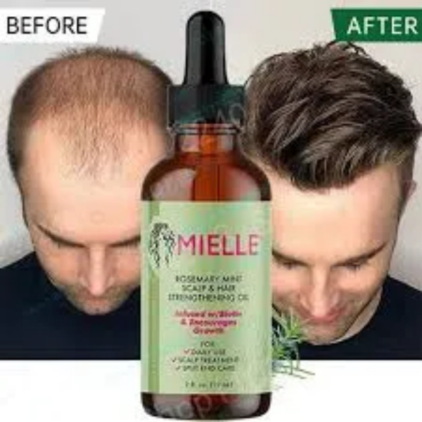Picture for category Hair germination and baldness treatment