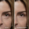 Dr. Melaxin Eyephalt Retinol Eye Bag Cream 10g Anti Aging Lifting Wrinkle care