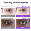 numbuzin No.9 Eye Patches | NAD+ Collagen Under | Dark Circles,...