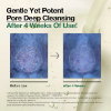 Anua Double Cleansing Duo Set